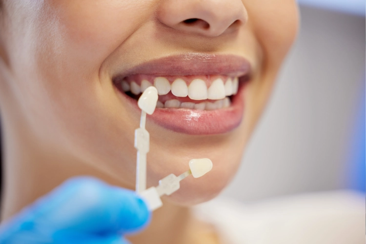 Patient receiving composite veneers at Heavenly Dental Surrey